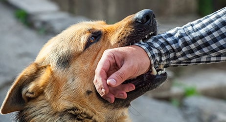 Benefits Of Hiring A Dog Bite Attorney